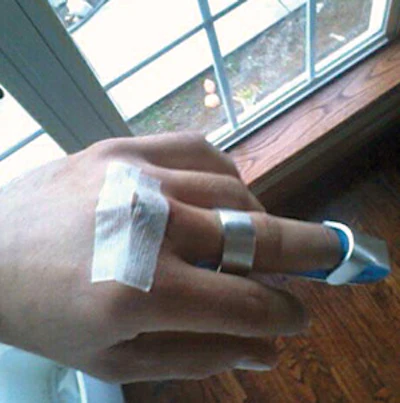 4 V 1219 Wfb Dj20 First Aid Mitchell Canter Hand From Story Sm
