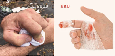 Good Bad Lacerations 1219 Med