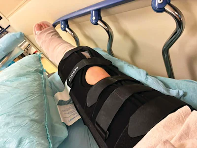 Person wearing black Breg knee brace with support straps in medical setting